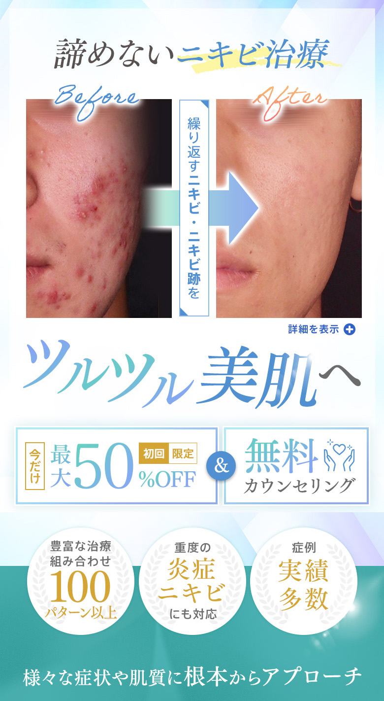 諦めないニキビ治療